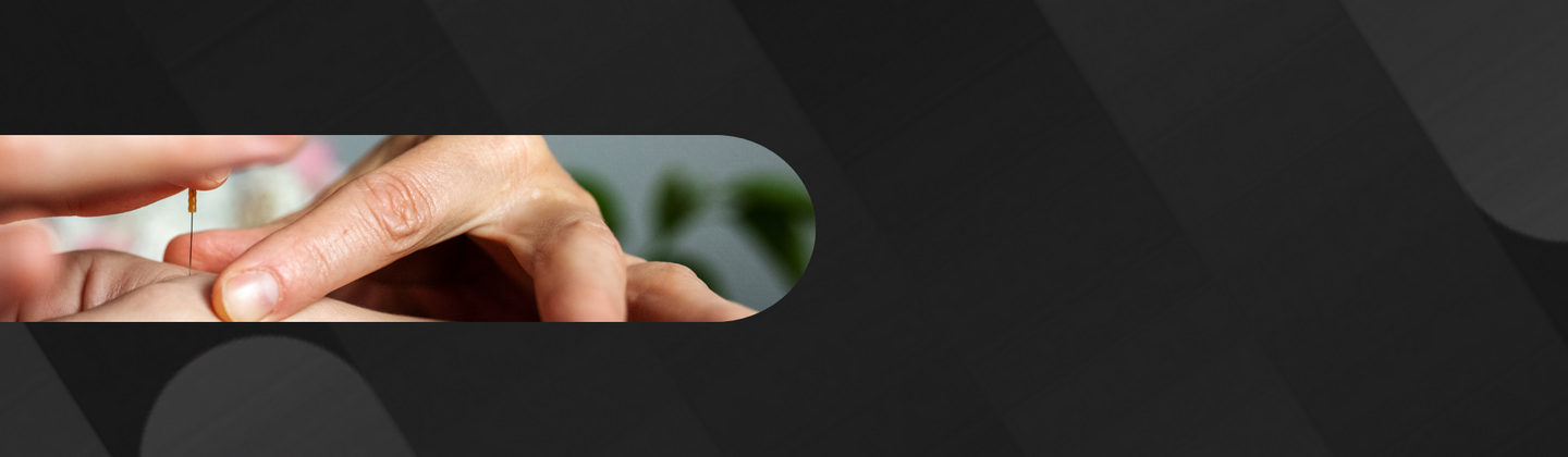 Acupuncture practitioner's hands inserting needle into patient's hand.